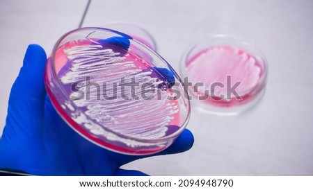 A scientist holds an open petri dish with colonies of white bacteria in his hand on a pink medium, close-up. Bacteriological test on special media.