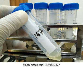 Scientist Inserting A Tube In A Laboratory Centrifuge For DNA Testing.