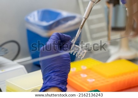 Scientist pipetting sample into vial for DNA testing. Scientist loads samples DNA monkeypox amplification by PCR into plastic strip tubes. Biochemistry specialist works with lab equipment