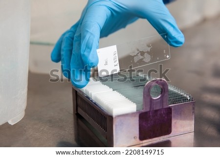 Scientist placing microscope slides with paraffin embedded tissue samples into a slide staining rack. Fluorescent Immunohistochemistry staining of paraffin-embedded tissue sections.