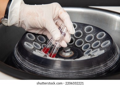 Scientist Placing Some Test Tubes Into The Centrifuge. Scientist Preparing Bone Marrow Samples For Flow Cytometric Analysis In The Laboratory.