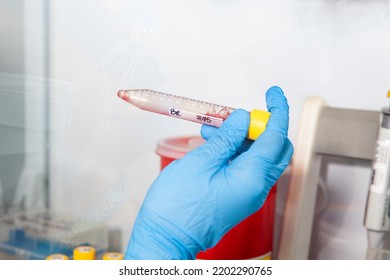 Scientist Preparing Blood Samples For Karyotipe And Fluorescence In Situ Hybridization In The  Laminar Air Flow Cabinet. Mixing Blood Sample And Reagents.