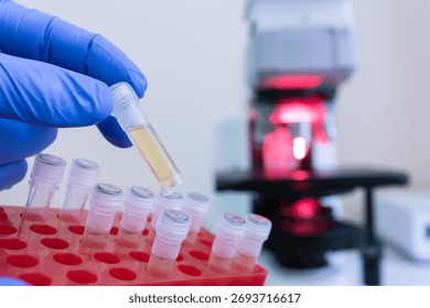 A scientist pulled out a single small test tube containing a test vaccine from a red rack of test tubes, with a microscope blurred in the background.