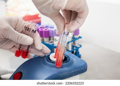 Scientist Using A Vortex To Mix Contents In A Test Tube. Scientist Preparing Bone Marrow Samples For Flow Cytometric Analysis In The Laboratory.