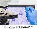 Scientist wear blue glove holding parafin human tissue block and out of focus microscope and computer monitor show glandular image.Medical patholology and cytology laboratory technology concept.