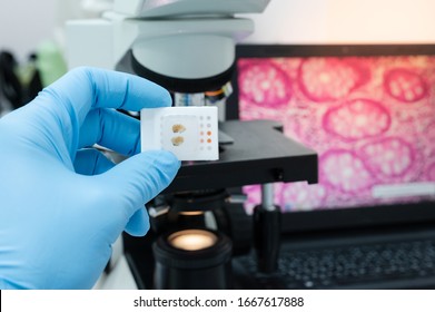 Scientist wear blue glove holding parafin human tissue block and out of focus microscope and computer monitor show glandular image.Medical patholology and cytology laboratory technology concept.