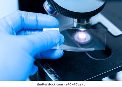 Scientist wear blue glove holding slide human tissue and out of focus microscope.Doctor is examining histological sample, a biopsy in the laboratory of cancer research.Medical patholology and cytology
