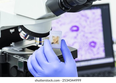Scientist wear blue glove holding parafin human tissue block and out of focus microscope and computer monitor show glandular image.Medical patholology and cytology laboratory technology concept.