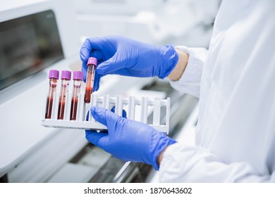Scientist wear glove holding test tube in sample rack to check qulity of sample.