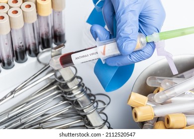 Scientists Hand Holding A Test-tube With Blood Sample For ANTHRAX VIRUS Test.