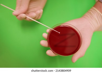 Scientists Are Holding And  Z-Line on Culture plate, Blood agar, Chocolate agar, MacConkey agar,  Selective Media for Gonococal Bacteria growth; bacteria culture.