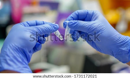 Scientists make liquid pipettes for Monkeypox research. Scientict in lab analysis of new Monkeypox, clinic laboratory chemical research of infection. Monkeypox concept.