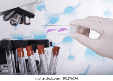 Scientists Slide Tissue Biopsy For Diagnosis In Pathology Laboratory (Parts Of The Rat Liver Through Dyeing)