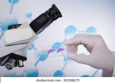 Scientists Slide Tissue Biopsy For Diagnosis In Pathology Laboratory (Parts Of The Rat Liver Through Dyeing)