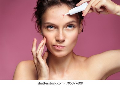 Scowling girl pointing at her acne and applying treatment cream. Photo of young girl with problem skin on pink background. Skin care concept
