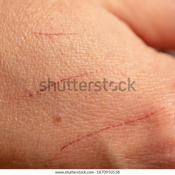 Scratches Claws Cat On Human Skin Stock Photo 1870950538 