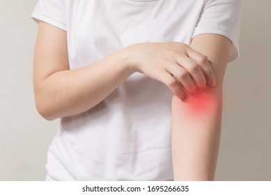 Scratching Arm, Itching Of Skin Diseases With Young Female And Have Red Around The Itching Area. Concept Healthcare.
