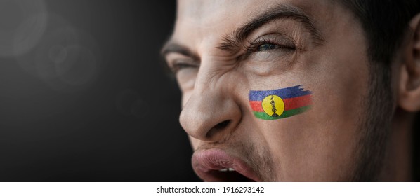 A Screaming Man With The Image Of The New Caledonia National Flag On His Face