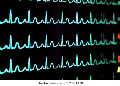 Screen with cardiogram 