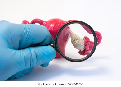 Search disease, abnormalities or pathology of ovary concept photo. Doctor holding magnifying glass and examines model of ovaries, conducting diagnostics for disease like cancer, apoplexy, cyst, POS