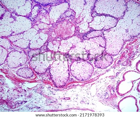 Sebaceous glands are holocrine glands whose cells accumulate clear lipid droplets. Finally, the cells die, which is indicated by their pyknotic nuclei, visible on left of the image, to form the sebum