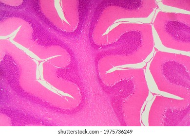 Section of a human cerebellum under the microscope