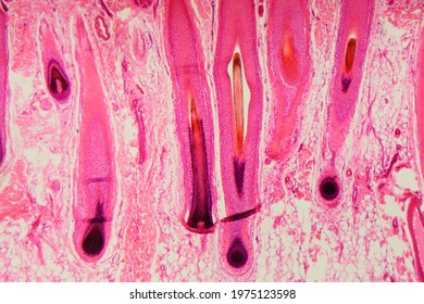 Section Of A Human Hair Follicle In Skin Under The Microscope