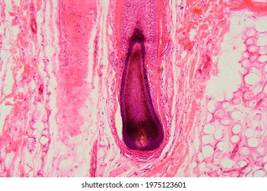 Section Of A Human Hair Follicle In Skin Under The Microscope