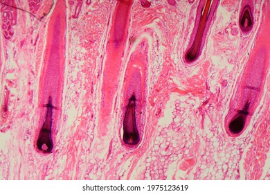 Section Of A Human Hair Follicle In Skin Under The Microscope