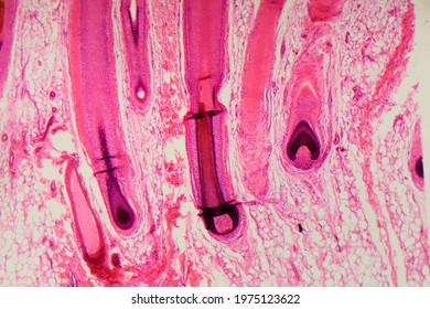 Section Of A Human Hair Follicle In Skin Under The Microscope