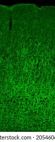 Section of mouse cerebral cortex, with oligodendrocytes labelled with immunofluorescence and visualized with a confocal laser scanning microscope