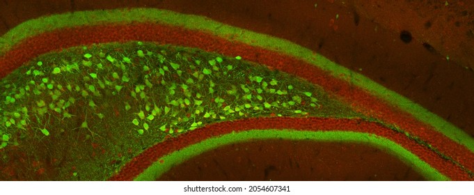 Section of mouse rostral hippocampus labelled with immunofluorescence and visualized with a confocal laser scanning microscope