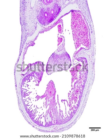 A section of a six-day-old chick embryo demonstrates the heart developing (Heart tube). Staining with hematoxylin and eosin.