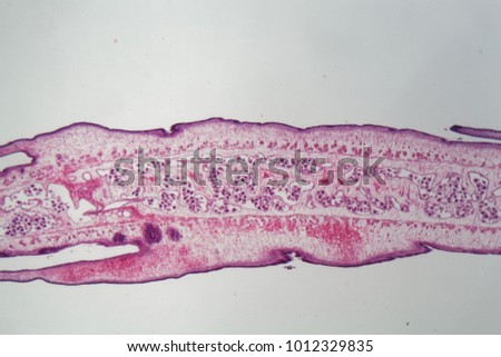 Segment of a tapeworm body (Proglottid) under the microscope.