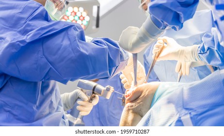 Selective Focus With Blurred Background.Orthopedic Surgeon In Blue Surgical Gown Suite Using Saw To Cut The Bone While Total Knee Replacement Surgery In Osteoarthritis Patient.Team Of Surgeons.