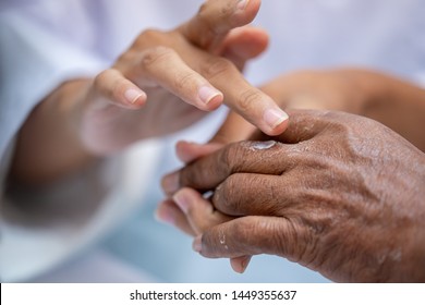 Selective Focus Close Up Woman Pharmacist Or Doctor Hand Apply Steroid Moisturizer Cream On Old Asian Man Hand With Flaking Dry Itchy Skin Conditions Peeling By Allergic Dermatitis.