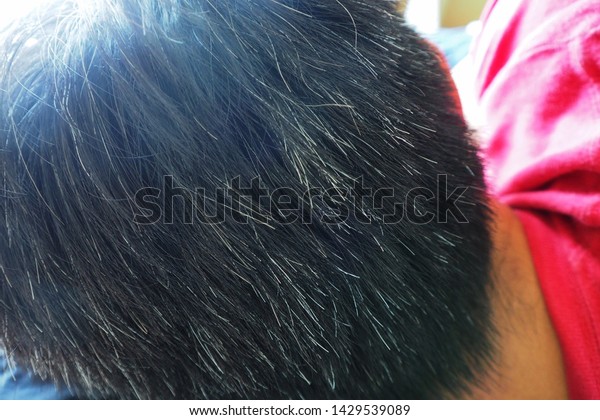 Selective Focus Grey Hair Old Asian Stock Photo Edit Now
