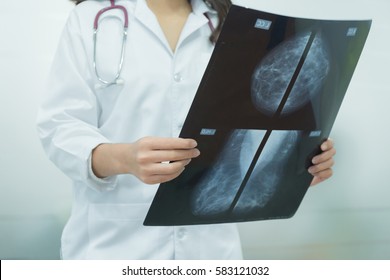 Selective focus Mammogram film image in female doctor hands.