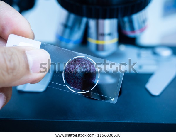 Selective focus microscope glass slide for\
scientist diagnosis blurry and microscope lens at cytology and\
pathology department in the\
hospital.