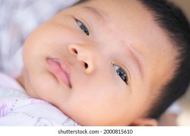 Selective Focus On The Baby's Eye With Dust. Disease Tear Ducts Tons Of Newborns. Nasolacrimal Duct Obstruction In Baby It Is A Blockage Of The Lacrimal Drainage System. 