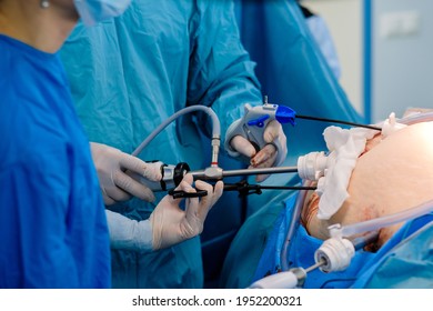 61 Advance Laparoscopy Surgery Images, Stock Photos & Vectors ...