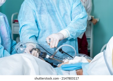 Selective focus on hands of surgeons manipulating surgical laparoscopic equipment. Surgical treatment of proctological diseases through punctures in the abdominal cavity.