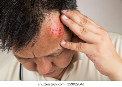 Head Bump Images Stock Photos Vectors Shutterstock