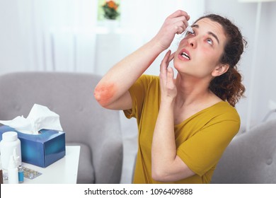 Self-treatment. Young Bruised Woman Staying At Home Recovering From A Car Accident Using An Eye Wash While Treating Multiple Minor Body Injuries