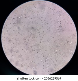 Semen Analysis Sperm Analysis On Microscopic Stock Photo 2086229569 ...