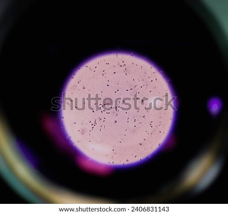 Semen analysis, sperm analysis on microscopic examination, Normozoospermia, normal semen study.