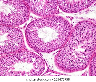 seminiferous tubule histology