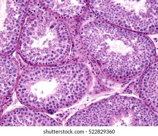 544 H&e stain Images, Stock Photos & Vectors | Shutterstock