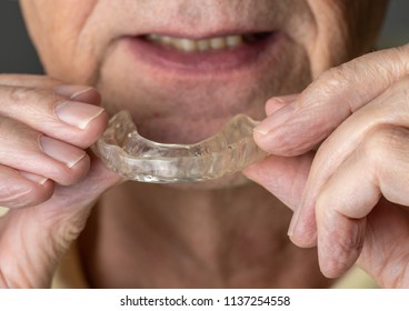 Senior Caucasian Man Putting Plastic Mouth Or Night Guard Onto Crooked Stained Teeth