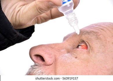 Senior Man Dripping A Red Bloodshot  Eye With Eye Drops On A White Background. Close-up Image